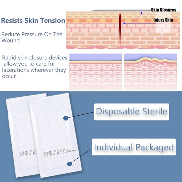 Hospital Surgical Sterile Wound Closure Strips Athletic Adhesive Skin Closure Strip