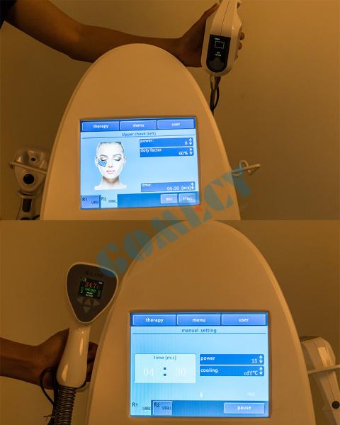 Máquina não cirúrgica do emagrecimento da cavitação de 220VAC 110VAC RF