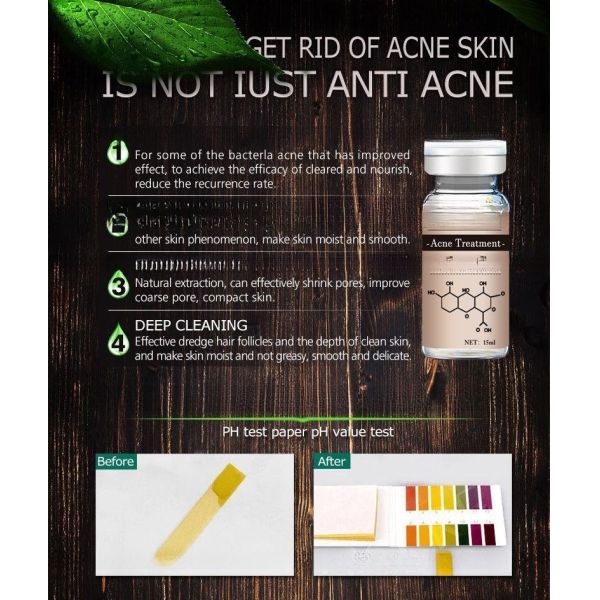 Mesotherapy Microneedling Serum Acne Treatment Original Stalidearm No Needle Mesotherapy