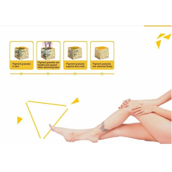 Picosecond Laser Machine For Tattoo Removal , Q Switch Laser Tattoo Removal Machine