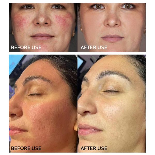 Масло морской шипы антиоксидант увлажняющий крем для лица отбеливающий натуральный органический Семена морской шипы