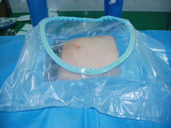 Disposable Surgical Caesarean drape color blue size 200*300cm