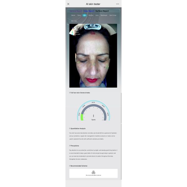 Skin Analyzer Reports Bitmoji Max Plus Facial Scanner Skin Scope Analysis Device