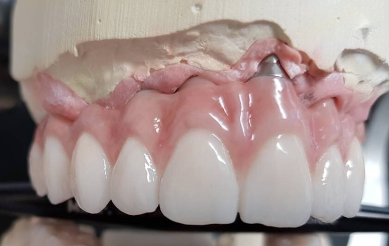 57% Translucent Yttria Stabilized Zirconium Preshaded Multilayer A1 98*18mm
