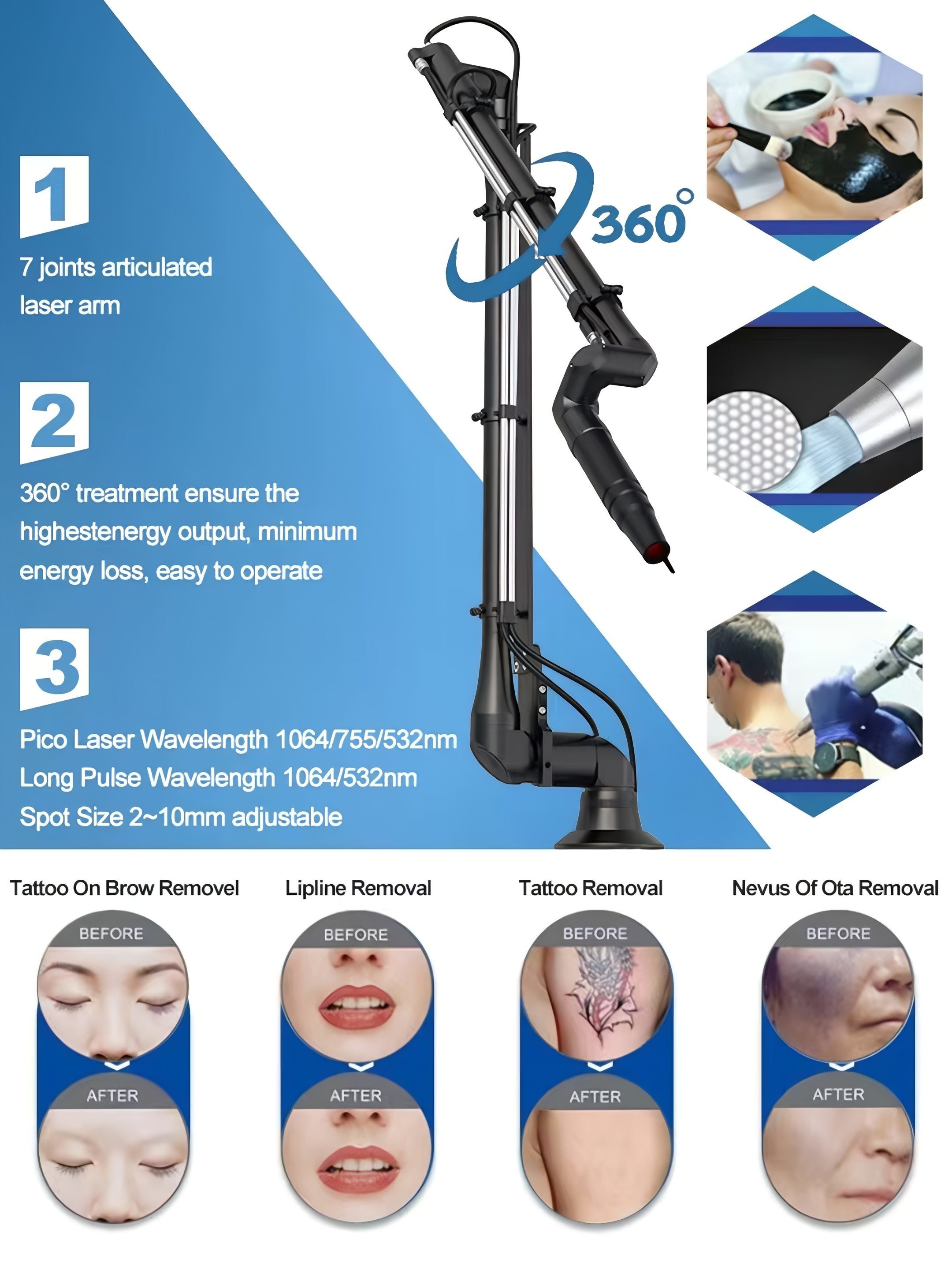 Advanced Vertical Pico Laser for Pigment & Tattoo Removal | High ROI Salon Device