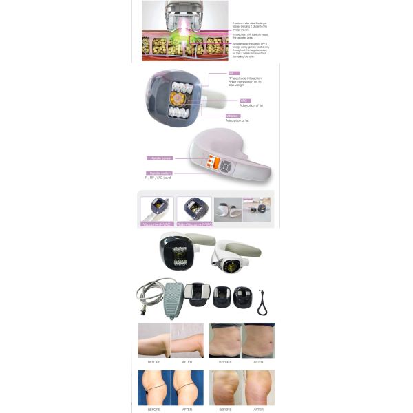 Body Vela Slimming Machine For Weight Loss Cellulite Removal Face Lifting