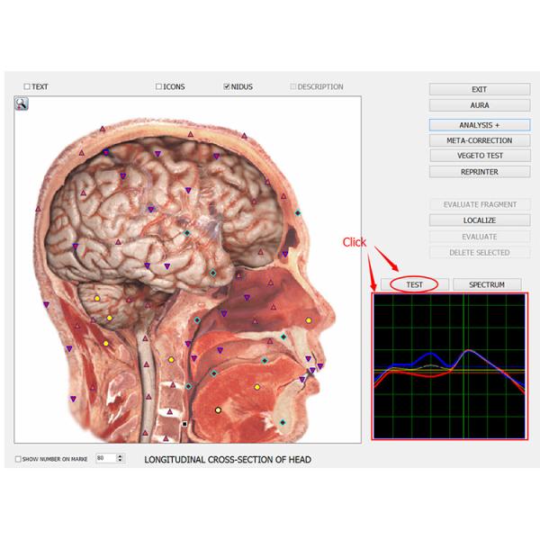 Software livre da actualização para o equipamento da saúde do corpo da versão 8D NLS/analisador clínicos do corpo
