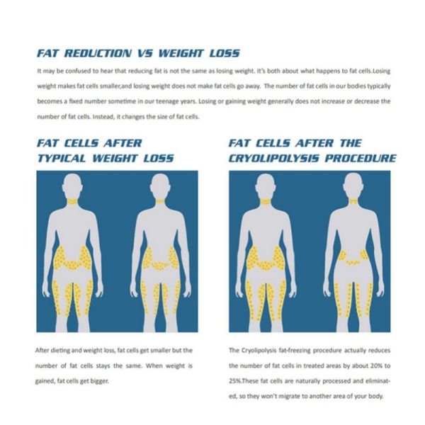 Newangie Nouvelle Arrivée Cryo 360 Cryolipolyse Élimination des Graisses Cryothérapie Machine Minceur Cryolipolyse