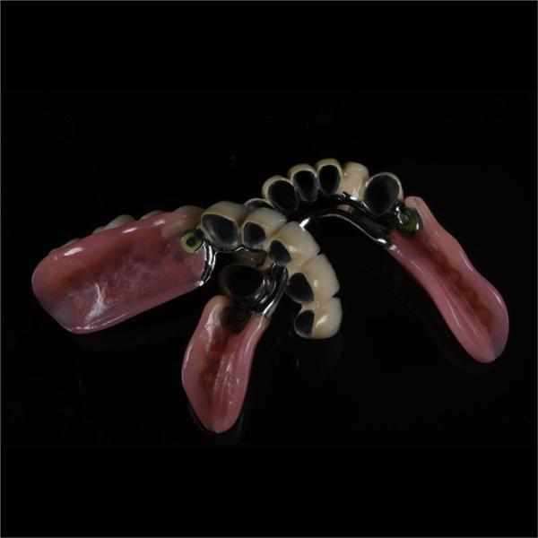Precision Zirconia PFM Crowns Partial Dentures Natural Looking