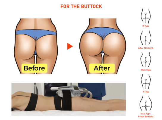 4 Handles Anti Cellulite Hi Tesla Slimming Weight Loss Building Muscle Lose Weight Machine