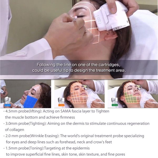 The Latest Korea Technology 7d HIFU 30000 shots Facial Lift Anti-wrinkle machine