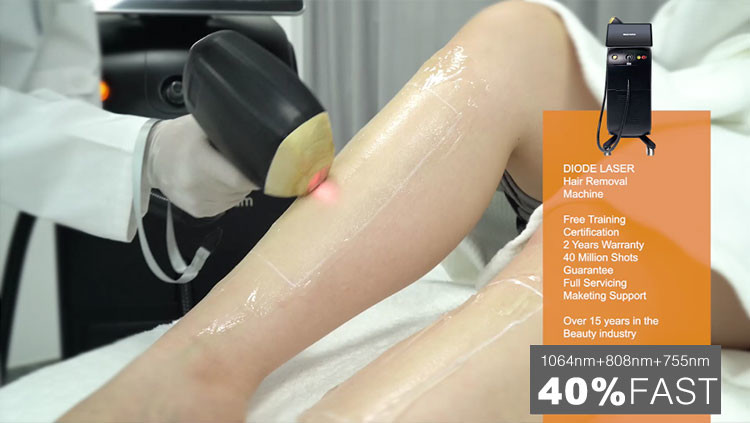 Laser permanente da velocidade 755nm 808nm 1064nm do diodo do gelo do comprimento de onda da máquina 3 da remoção do cabelo do laser