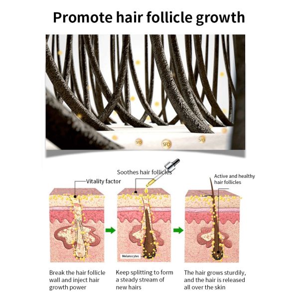 Органическая сыворотка роста волос на лице сыворотки 30ml роста волос бороды