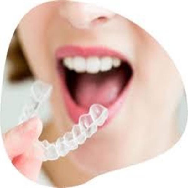 PETG Sheet Roll 1mm Sheet Glossy Transparent PETG Plastic Invisalign Teeth Aligners