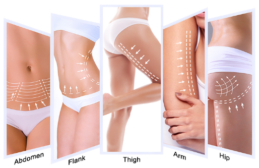 Ультразвуковая кожа машины красоты Хифу укрепляя оборудование Хифу 5Д 7Д