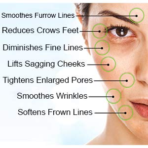 Сыворотка стороны Хялуроник кислоты органическая для выступать за и умаляет линии и морщинки