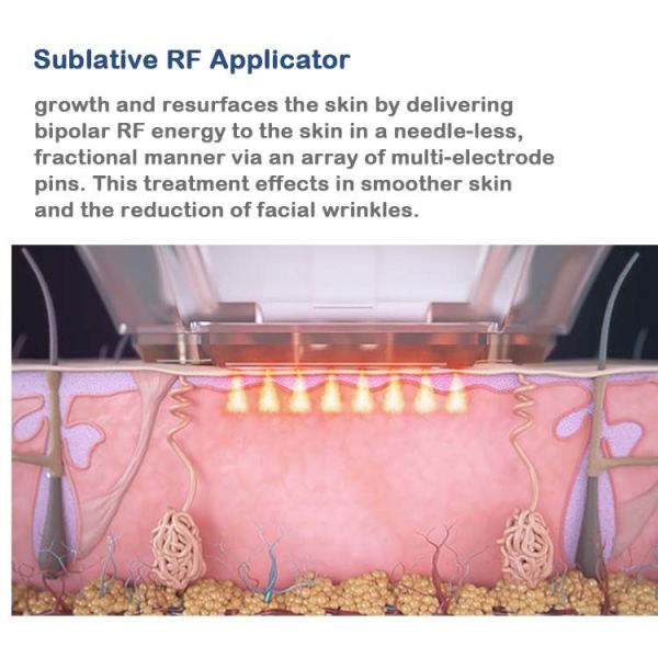 Rf Power Microneedling Fractional Rf Microneedle Scarlet Устройство с вакуумом