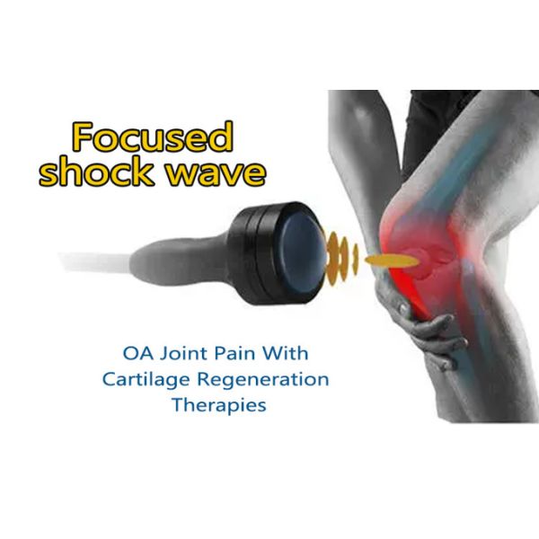 Физиотерапия Физиотерапия Лечение боли ESWT ударная волна двойные ручки сфокусированная ударная машина
