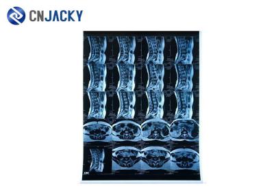 150 Micron A4 Size 0.15mm Blue X Ray Film