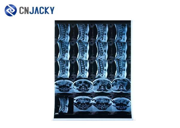 150 Micron A4 Size 0.15mm Blue X Ray Film