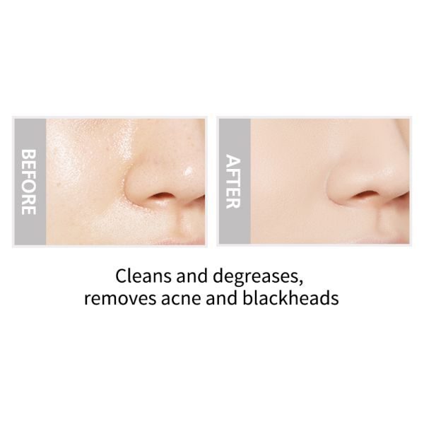 Acne Blackhead 1kg Volcanic Dead Clay Mask OEM Private Label