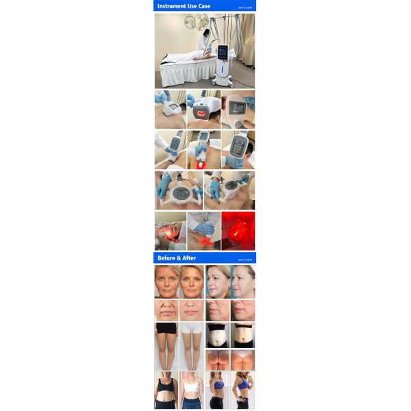 4 in 1 Vela Body Slimming Beauty Machine for Wrinkle Removal Cellulite Removal