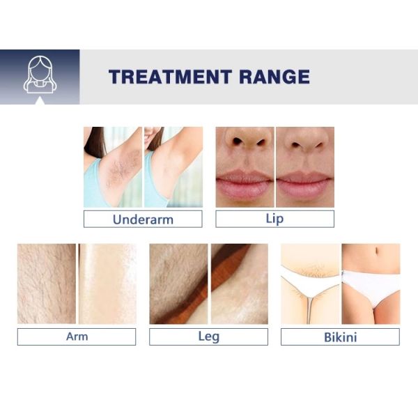 High Power 808nm Germany Diode Laser Hair Removal Beauty Machine Device