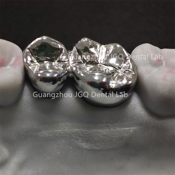 CNC 3D Printing All Metal Crowns Titanium Cobalt Chromium Alloy China Dental Lab