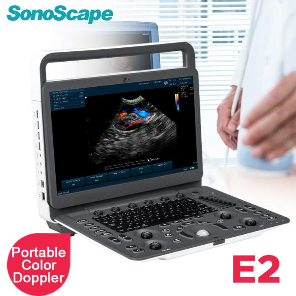 Doppler Color Ultrasonic Ultrasonido Portatil SonoScape E2