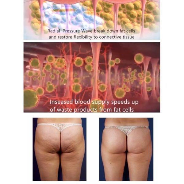 Машина лазера физиотерапии облегчения боли