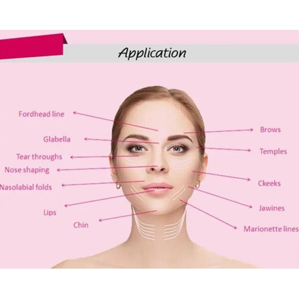 Blunt Cannula Needle Minimizes Tissue Trauma and Vascular Injury for Smooth Procedures​​