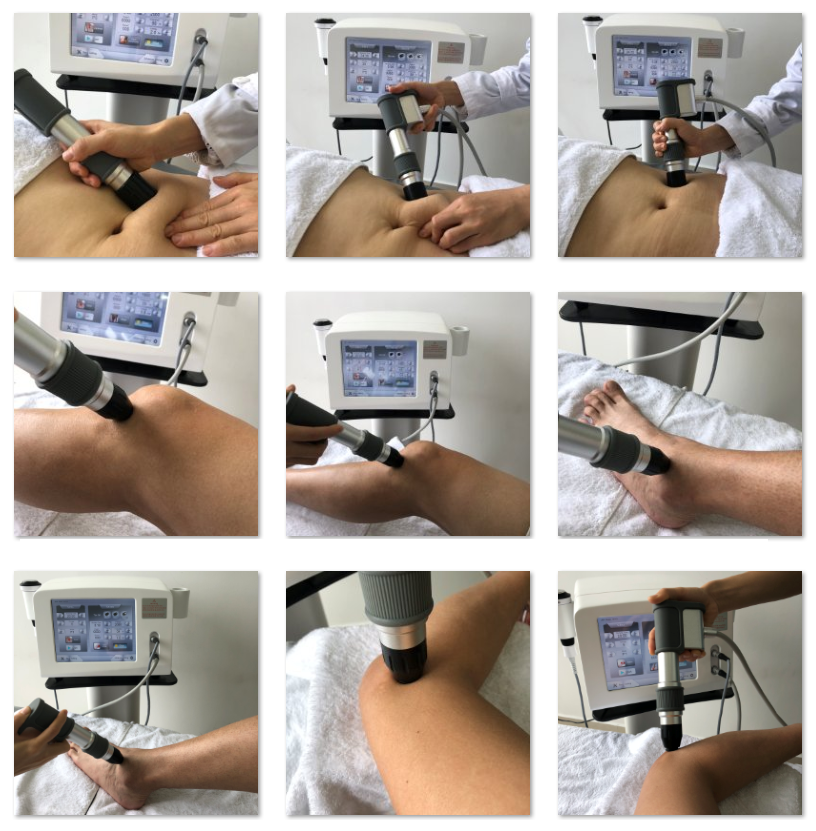 Облегчение боли машины терапией ударной волны ультразвука ESWT внекорпусное