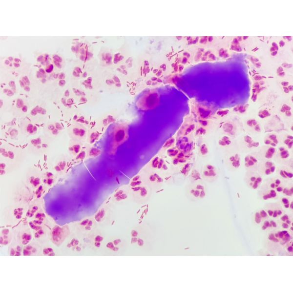 Método S-M para el diagnóstico