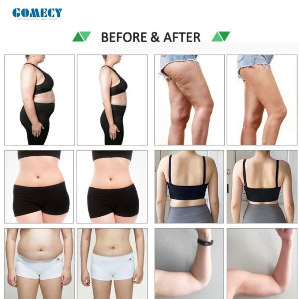 CE 10 Green Luxmaster Slim Lipo Laser Therapy Machine для снижения жировых отложений на спине