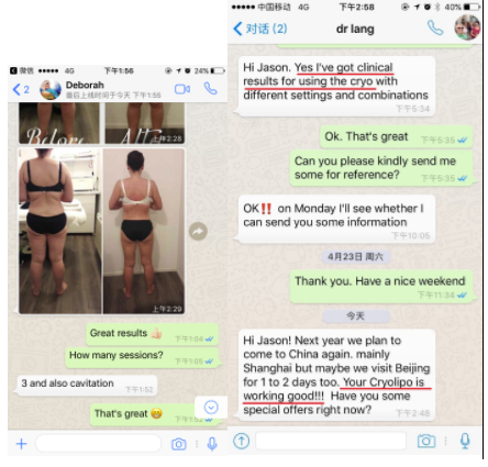 Best 4 Cryo Handles Double Chin body shaping Fat Freeze Cryolipolysis Beauty Machine