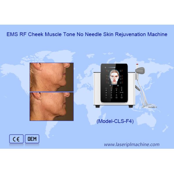 Reduction Facial Wrinkles Hi Emt Machine With 200μs Pulse And Biphasic Wave Shape