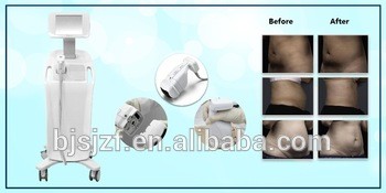 Pure White Grey Hifu Machine Wrinkle Fat Removal With 2 Treatment Heads