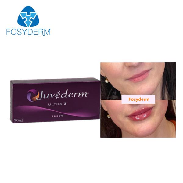 Injeção ácida hialurónica ligada dos enchimentos do bordo de Juvederm 2*1ml cruz cutânea para antienvelhecimento