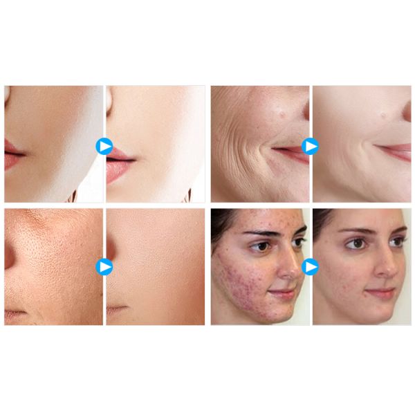4 Colors Flexible Face LEDs-Lights Therapy Lamp Panel Reduce Wrinkle Beauty Facial Machine
