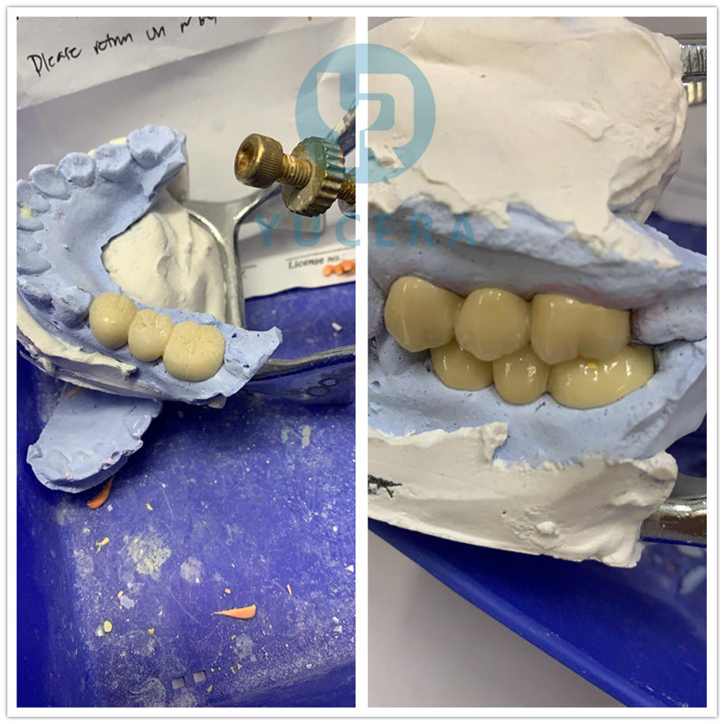 CE ISO одобрил неподвижный подъемный блок Zirconia зубоврачебного блока Zirconia полный