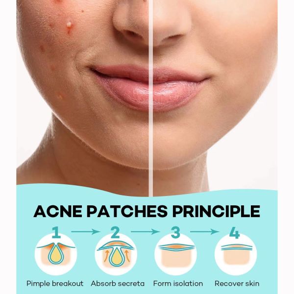 Colorful Heart Shaped Acne Pimple Patch Spot Treatment Patches for Face 12mmx6