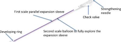 Safety Performance Kyphoplasty Kit Vertebral Expansion Balloon Kit Easy To Operate