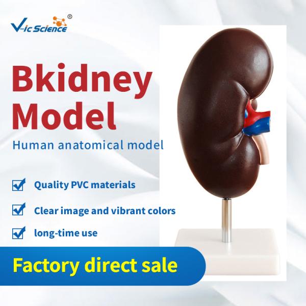 Medical Human Anatomical Model Plastic Kidney Anatomy Model 2 Parts VIC-310-2