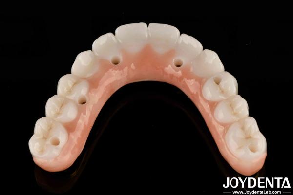 Barre de titane de longue durée Zirconia pont hybride d' apparence naturelle esthétique pour la restauration