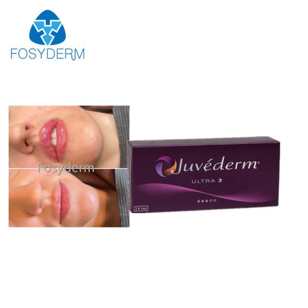 a cruz cutânea do enchimento de Juvederm do realce do bordo 2x1ml ligou a injeção ácida hialurónica