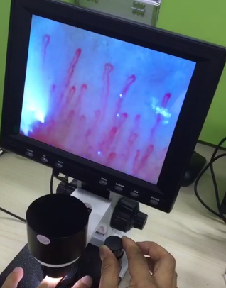 Colour Clincial Blood Analysis Medical Microscope For Improving Human Body Health