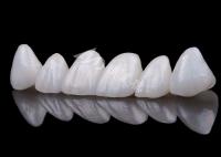 Coronilla de dientes de zircón de aspecto natural Resistencia a manchas Toda la corona de zircón