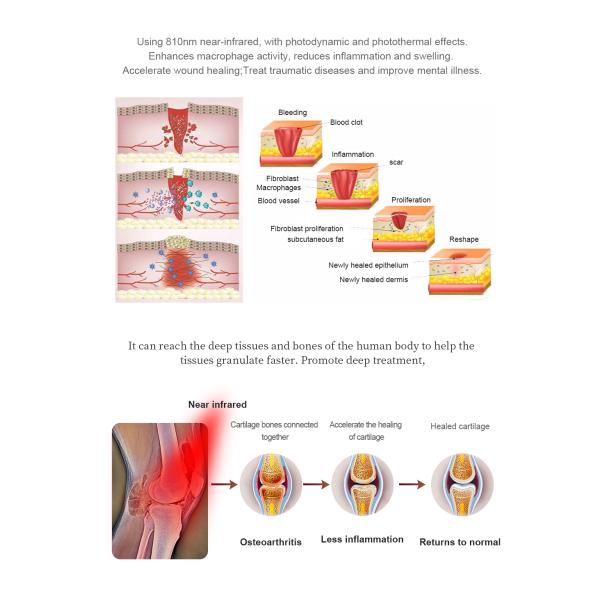 100 - Тюфяк физиотерапии тела СИД 240VAC 792pcs полный