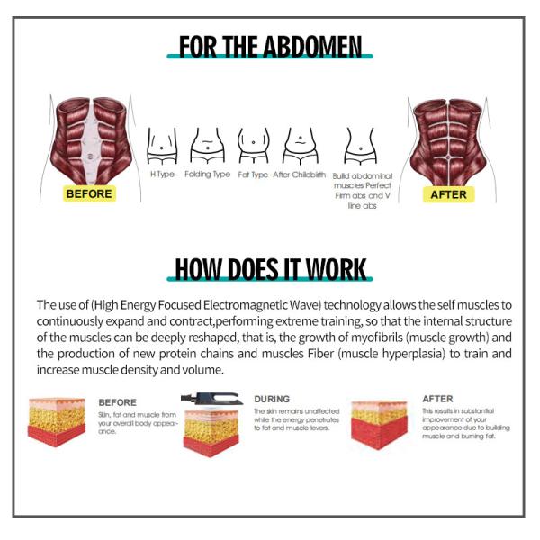 Electromagnetic Wave Energy Muscle Sculpting Machine Strengthening Burn Fat