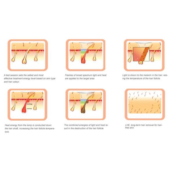 Professional 808 Nm/ 810 Nm Diode Laser Hair Removal Equipment For Full Body